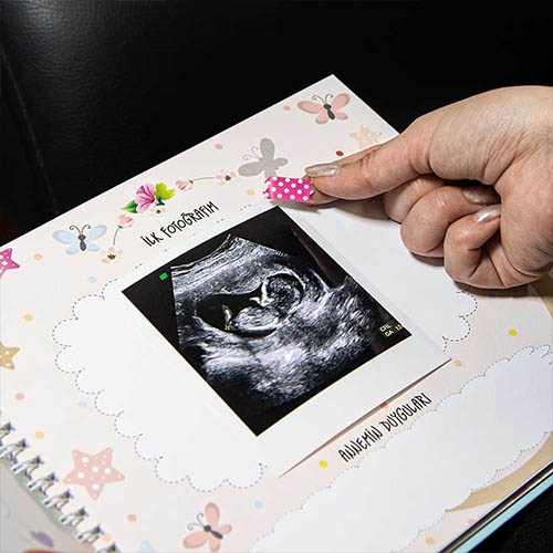 Hamilelik Ve Anne Bebek Günlüğü - Anı Defteri